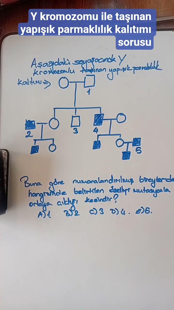 Y kromozomuna bağlı hastalık ya da özellikler(yapışık parmaklılık)